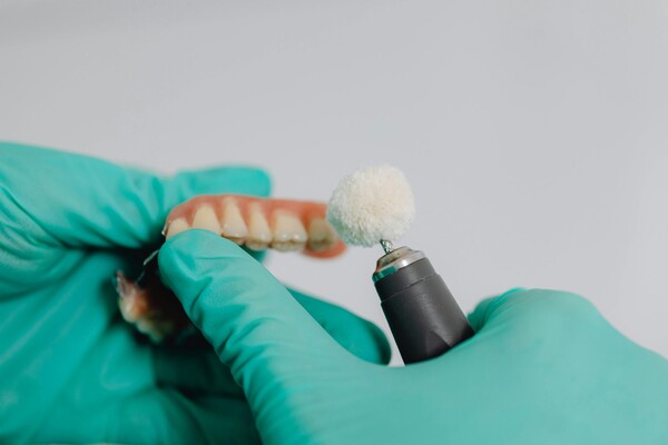 Wax up un silikona veidnes: kā tiek plānota estētiskā zobu ārstēšana